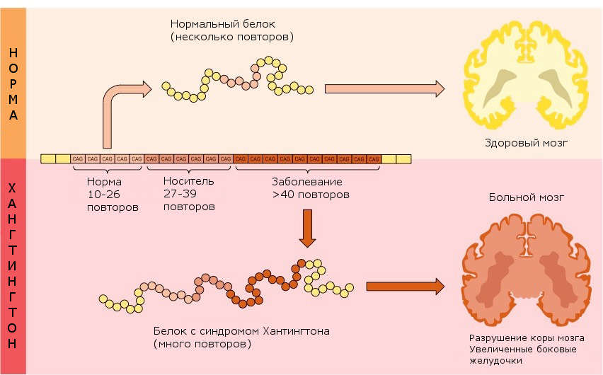 Болезнь Гентингтона патогенез. Болезнь Хантингтона патогенез. Болезнь Гентингтона патогенез схема. Хорея Гентингтона патогенез.